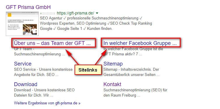 Was sind Sitelinks?
